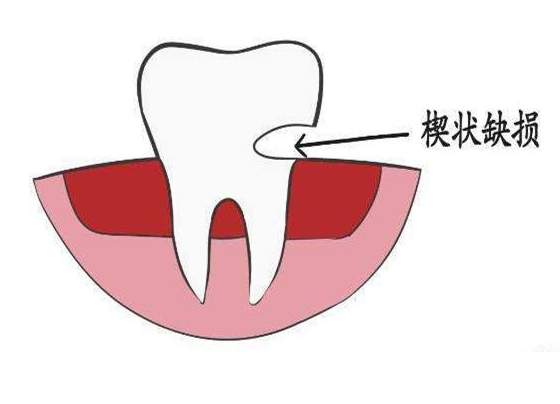 深圳牙科醫院，<a href='/' target='_blank'><u>深圳善貝口腔</u></a>